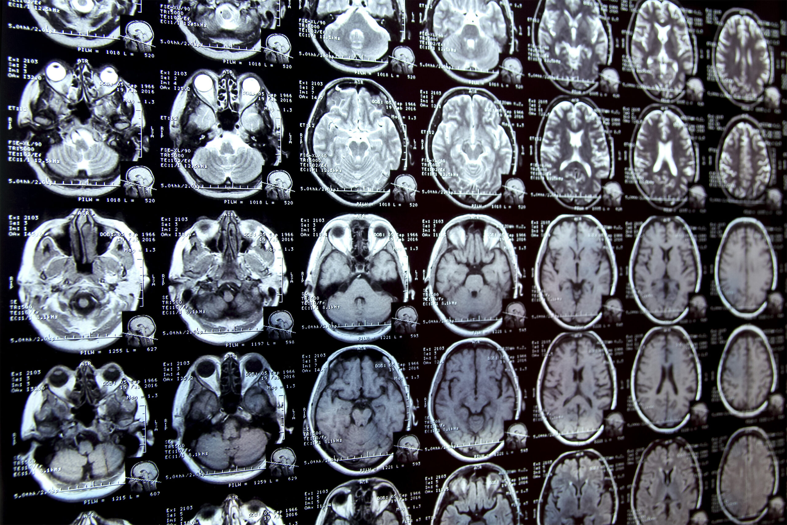 Revolutionary AI Tool Transforms Medical Image Segmentation for Clinical Research